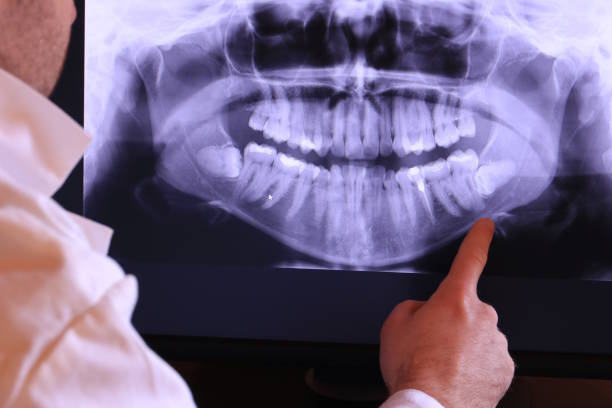 Best Dentist for Tooth Abscess  in Wfield, IN