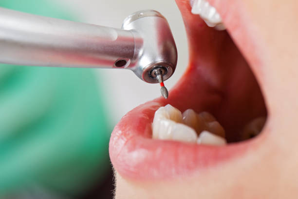 Best Emergency Tooth Extraction  in Wfield, IN